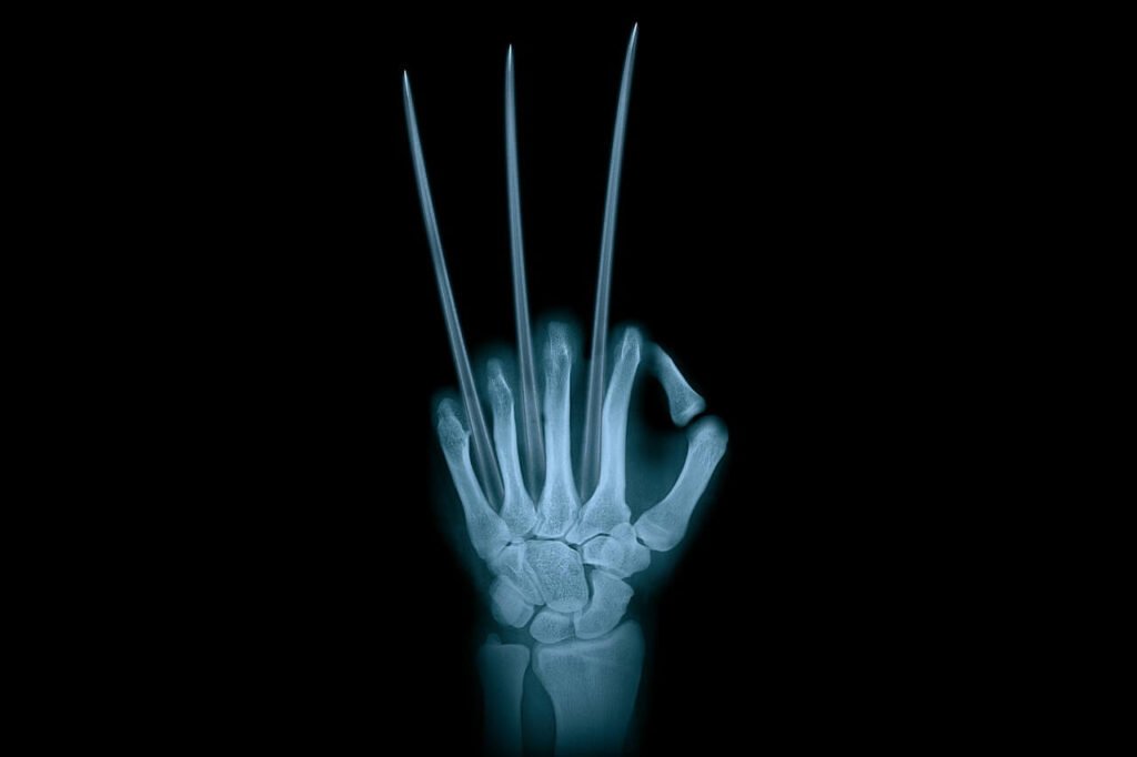 Adamantium existe